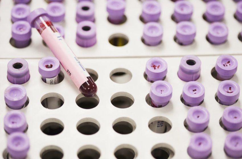  New guidelines offer updated approach for managing high cholesterol : NPR