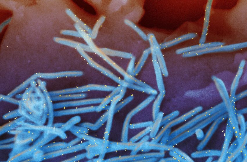  RSV shots for babies under FDA review despite evidence of safety : NPR