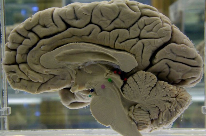  Tips to exercise your brain to lower risk of dementia