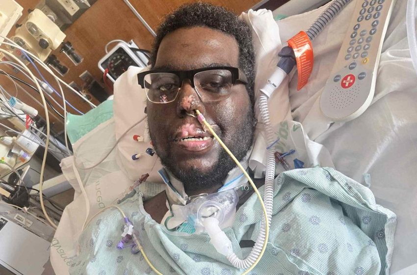  Dad of 2 Leaves Dentist’s Office with Bleeding Gums. A Month Later, He Had 3 Limbs and His Hand Amputated