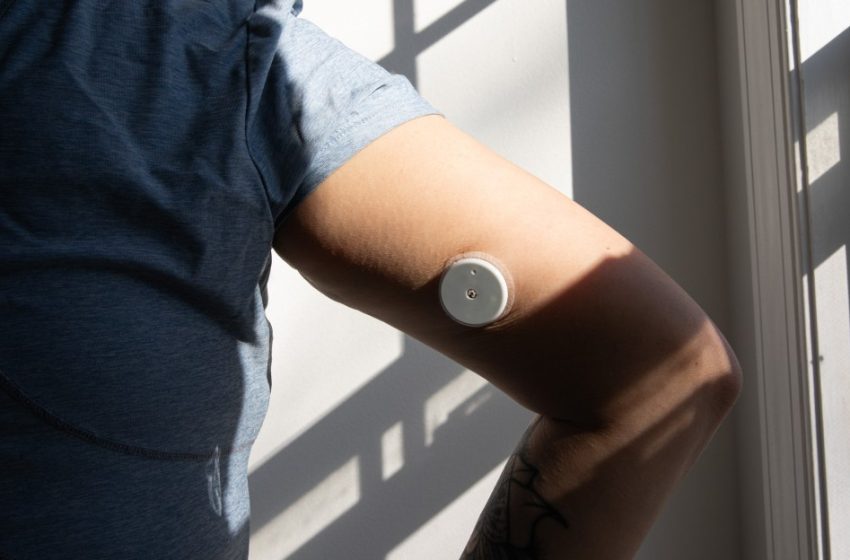  Continuous glucose monitoring made me continuously crazy