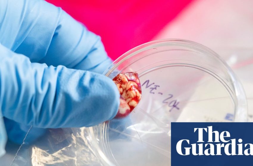  CDC temporarily halts testing for several infectious diseases amid staffing shortages | Trump administration