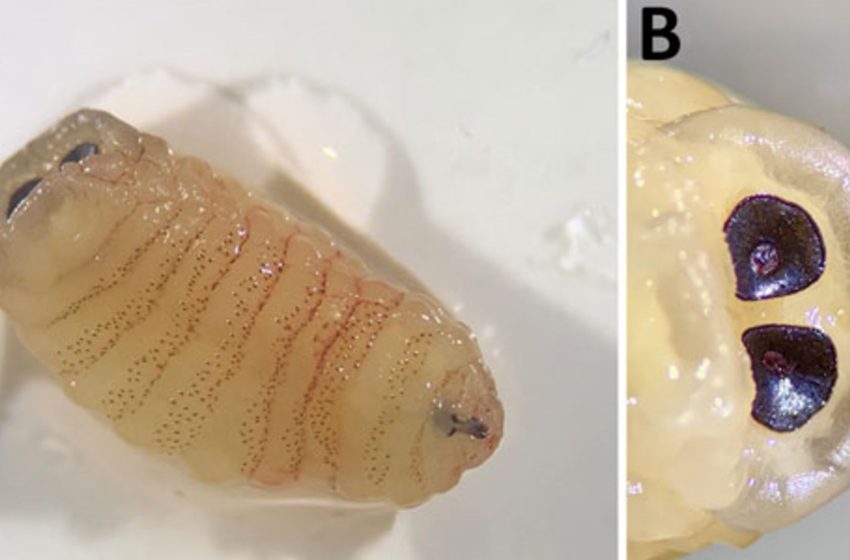  Diagnostic dilemma: Woman’s ‘biologically implausible’ infection led her to sneeze ‘worms’ out of her nose