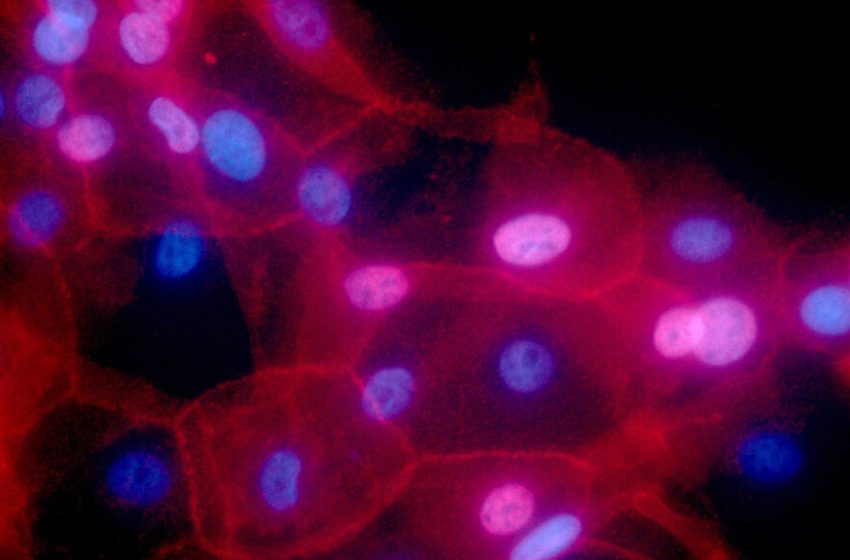  Study finds missed opportunities for targeted cancer treatments