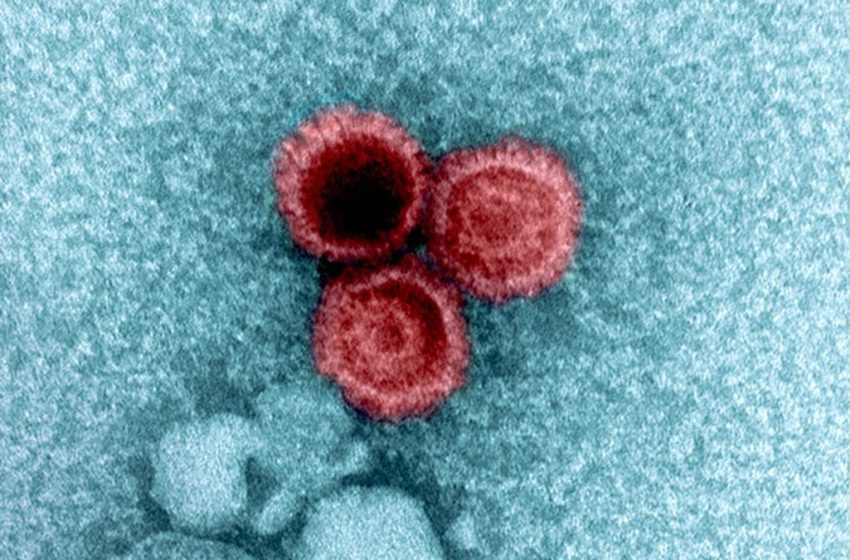  Giant Study Reveals Why Some Viruses Hide Inside Your Body For Life : ScienceAlert