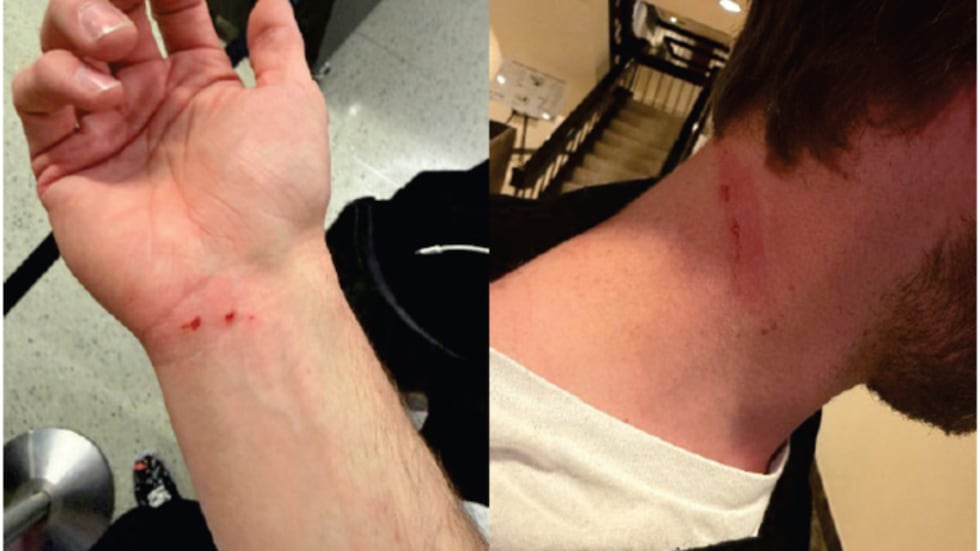 Photos of injuries sustained to the wrist and neck of one victim