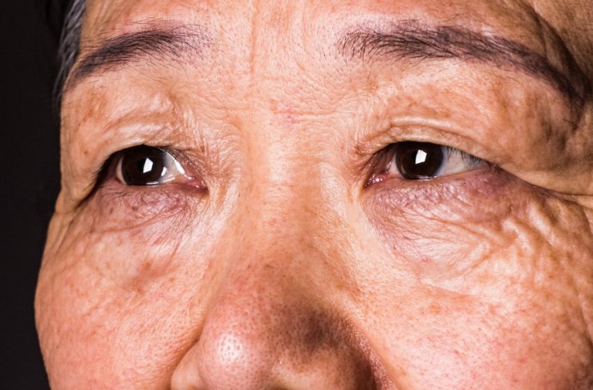  Your Vision Can Predict Dementia 12 Years Before a Diagnosis, Study Suggests : ScienceAlert