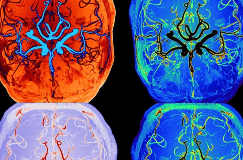  Scientists Watch Brain’s Self-Cleaning Process During Sleep in Real Time