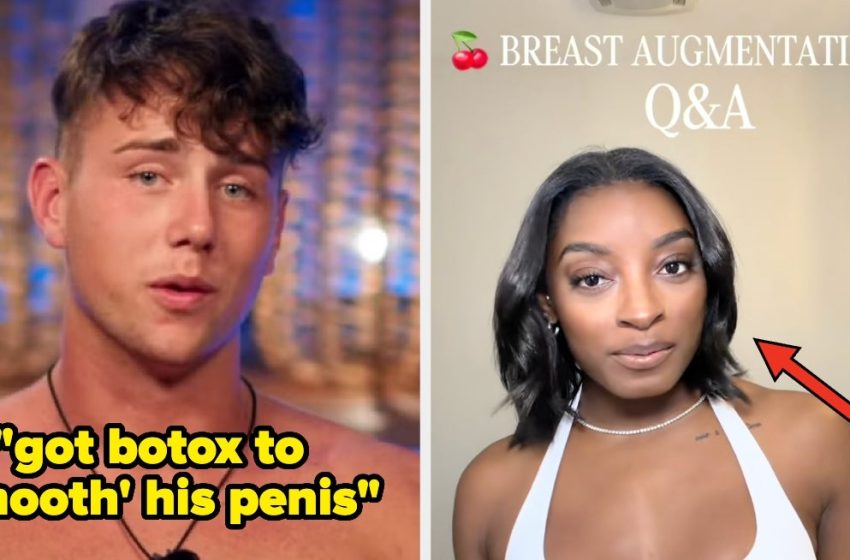  32 Famous People Talk Plastic Surgery