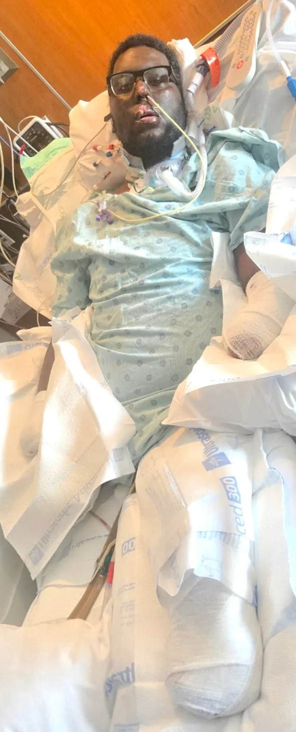 Vanterpool had to undergo amputation of four limbs. / GoFundMe/Alicia Wilder