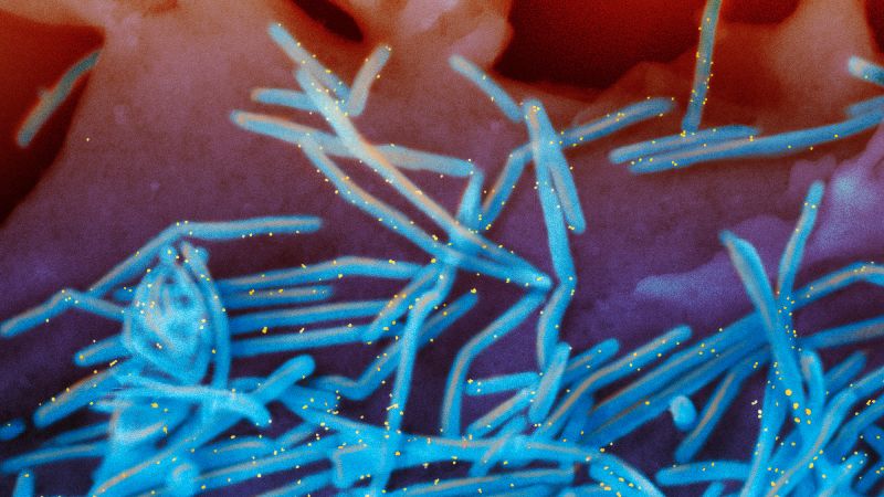  RSV is still spreading, prompting states to extend the immunization period