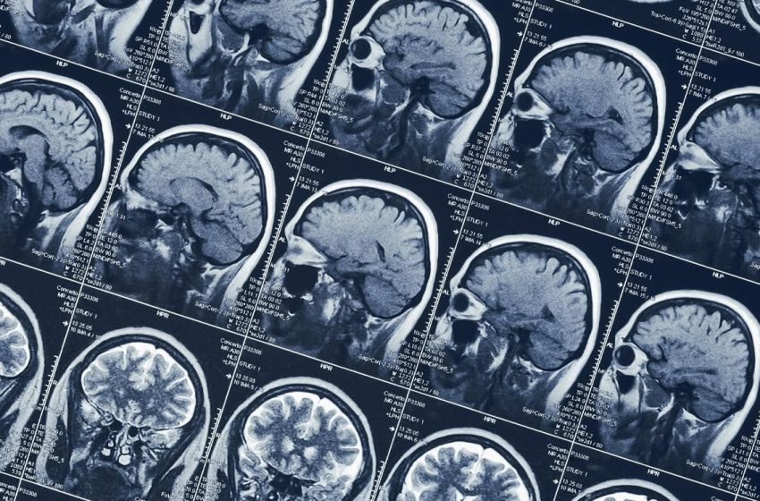  Brain scans reveal how a woman voluntarily enters a psychedelic-like trance without drugs