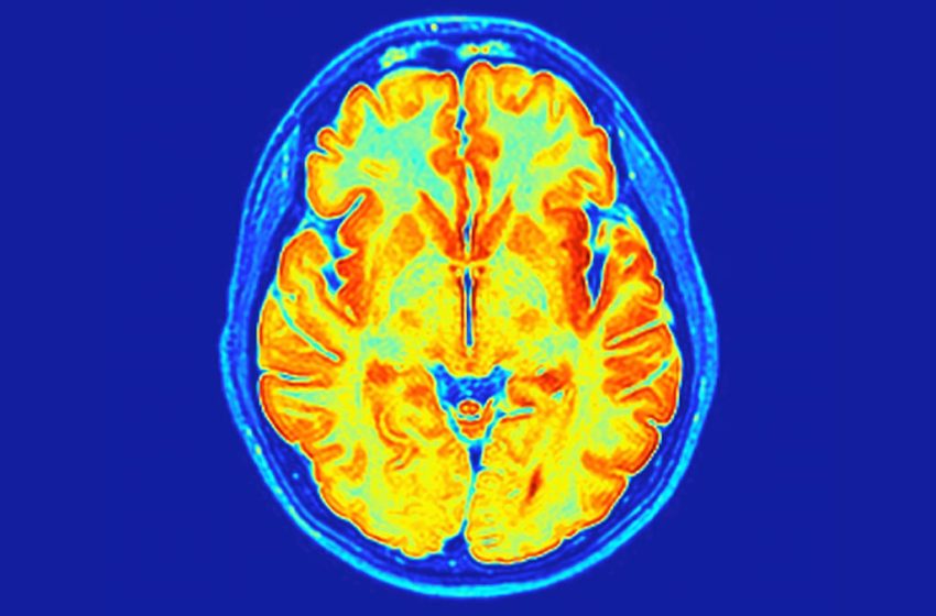  Scientists Have Found a New Neurodevelopmental Disorder Hidden in Our Genes