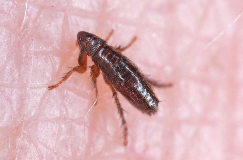  Typhus Cases Reach Record Levels In LA County With 9 Of 10 Requiring Hospitalization